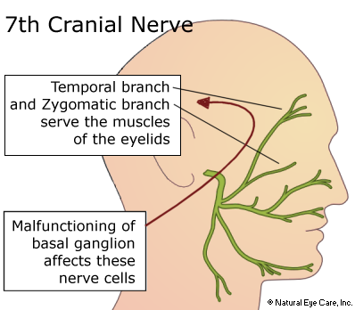 7th Cranial Nerve