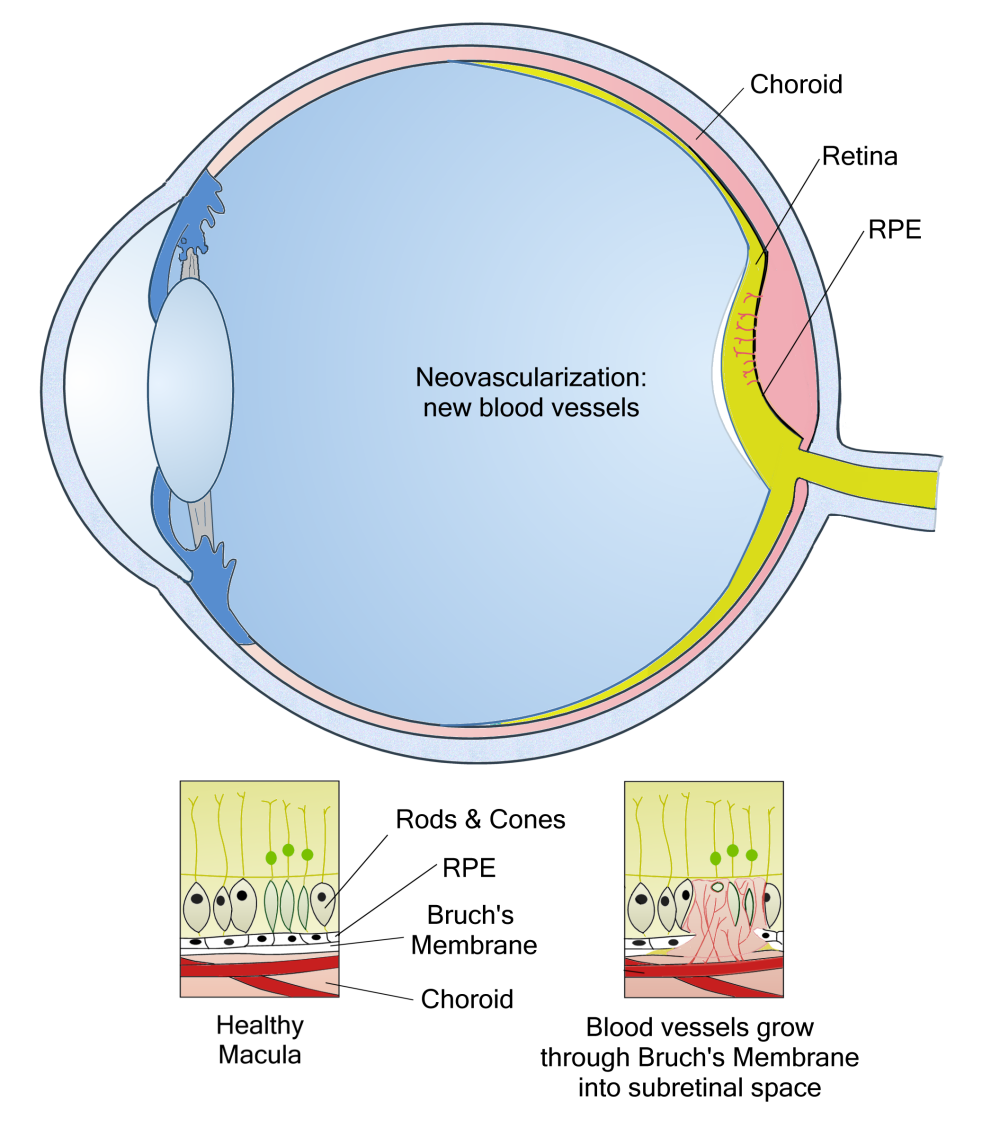 Image Result For A To Z Eye Care Image Result For A To Z Eye Care
