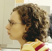 Myopia Myopia