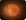 Vitreous Detachment